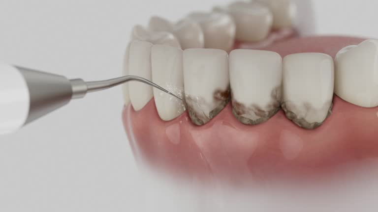 Reliable Dental Implants contractor in Lepanto, AR by Smile Center Dentistry
